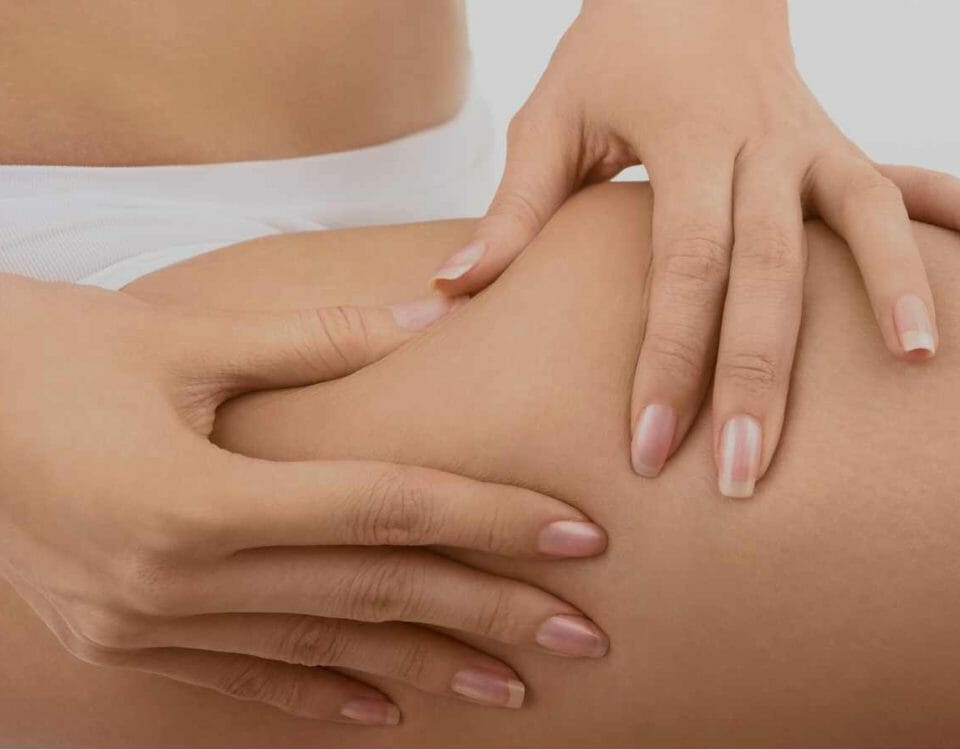 cellulite, trattamenti olistici cellulite, massaggio cellulite, corso massaggio cellulite